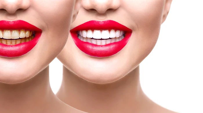FOTO: Shutterstock