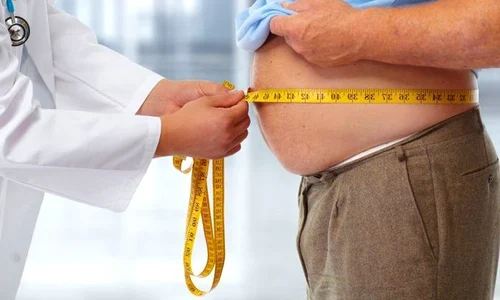 1 obezitate jpg jpeg