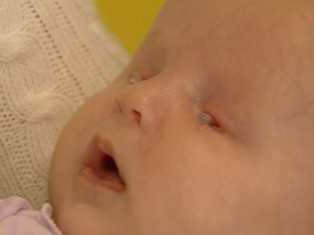 
    Micuţa Brielle nu va putea vedea niciodată  