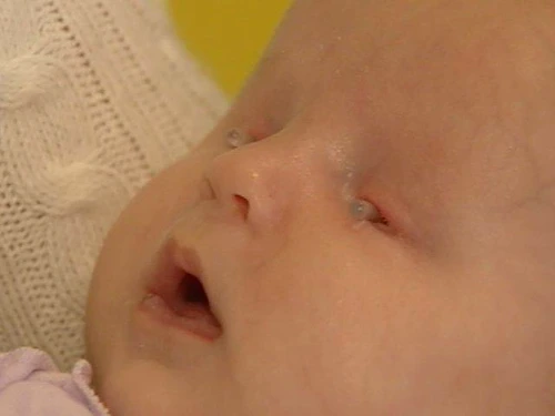 Micuţa Brielle nu va putea vedea niciodată