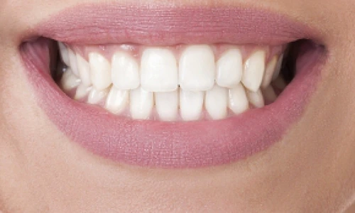 1 84327 original jpg jpeg