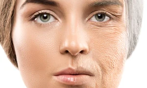 colagen jpg