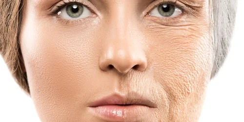 colagen jpg