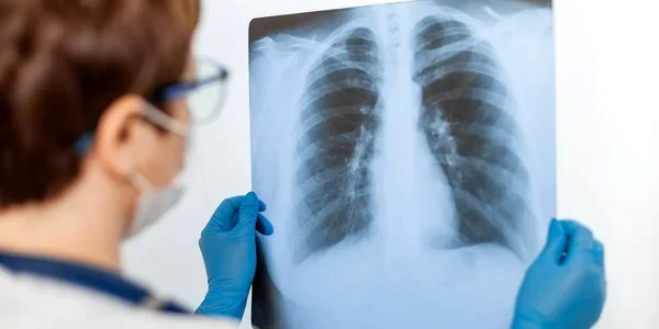 cancer pulmonar 2 jpg