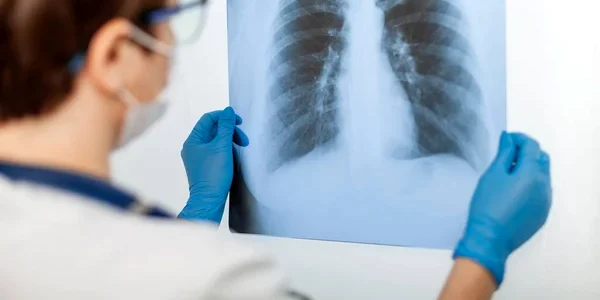 cancer pulmonar 2 jpg