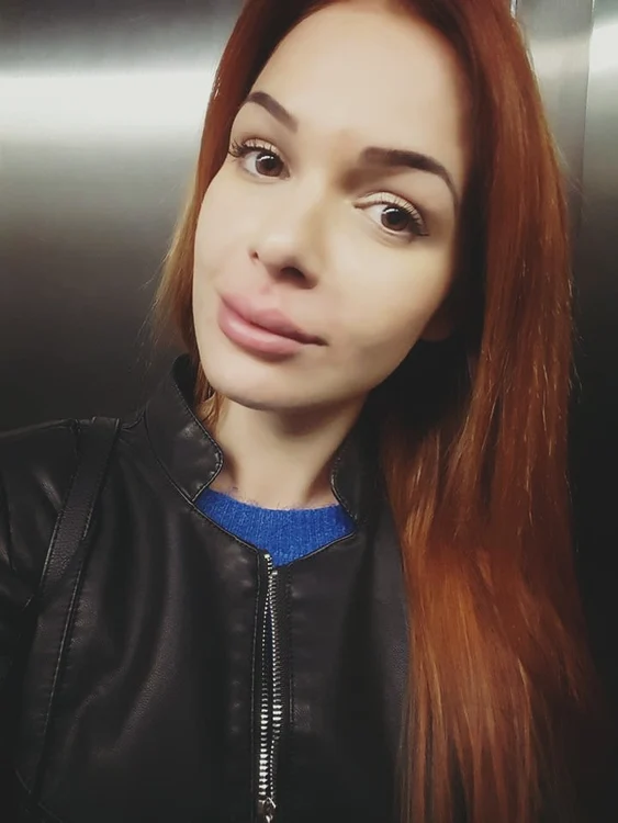 Deea Maxer a decis că-și dorește buze mai mari