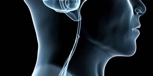 Stimularea cerebrală profundă se realizează prin impulsuri electrice 
