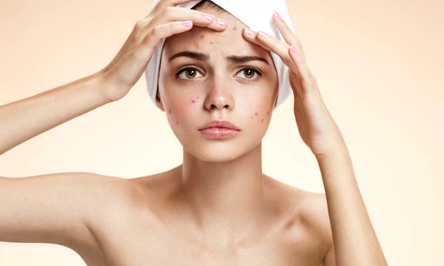 1 85103 original jpg jpeg