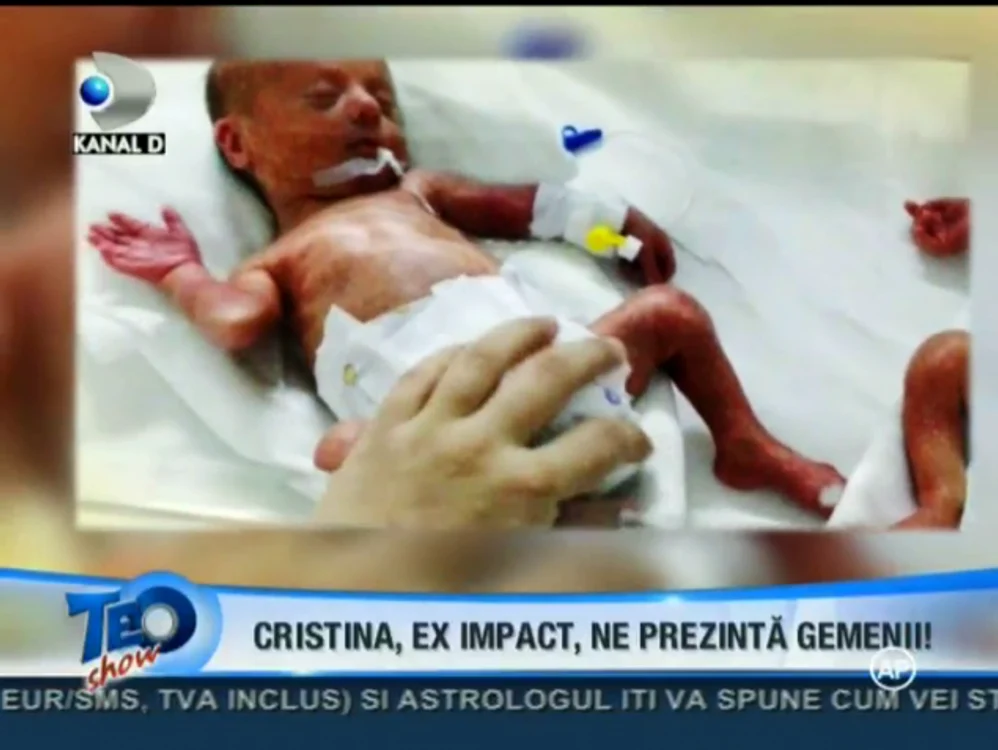 Unul dintre gemeni (captură: Kanal D)