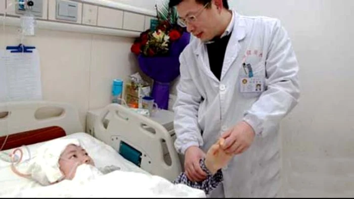 Viermele a stat timp de şase ani în capul femeiiFoto: Mirror.uk