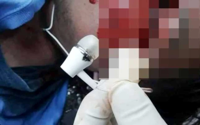 Un adolescent de 16 ani a murit după ce a adormit cu căştile telefonului în urechi FOTO metro.co.uk