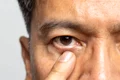 image png