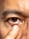 image png