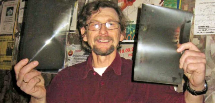 Konstantin Ceabaniuk prezintă radiografiile care demonstrează că soţia sa, Ala, a fost rănită în Oltenia