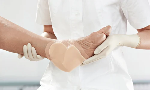 escarele tot ce trebuie sa tii despre ulcerele de decubit i ingrijirea corecta a acestora1 jpg