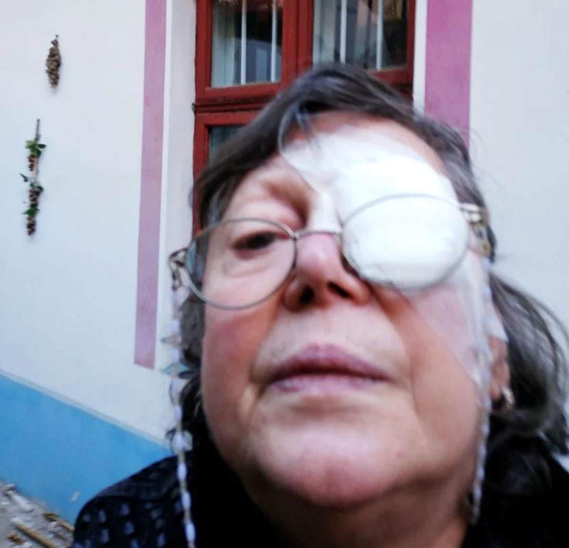 Anca Pandrea s-a operat la ochi
