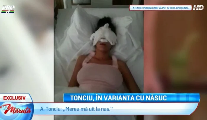 Andreea Tonciu are nevoie de calmante ca să scape de dureri