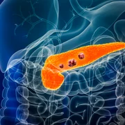 pancreatic cancer shutterstock 2264439379 (1) jpg