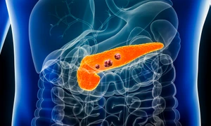 pancreatic cancer shutterstock 2264439379 (1) jpg