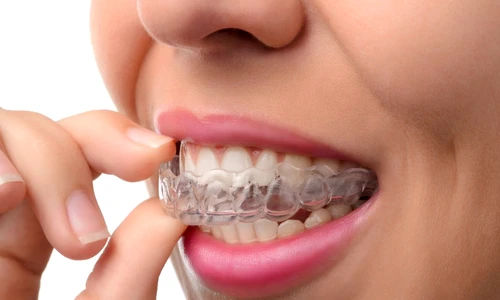 1 76710 original jpg jpeg