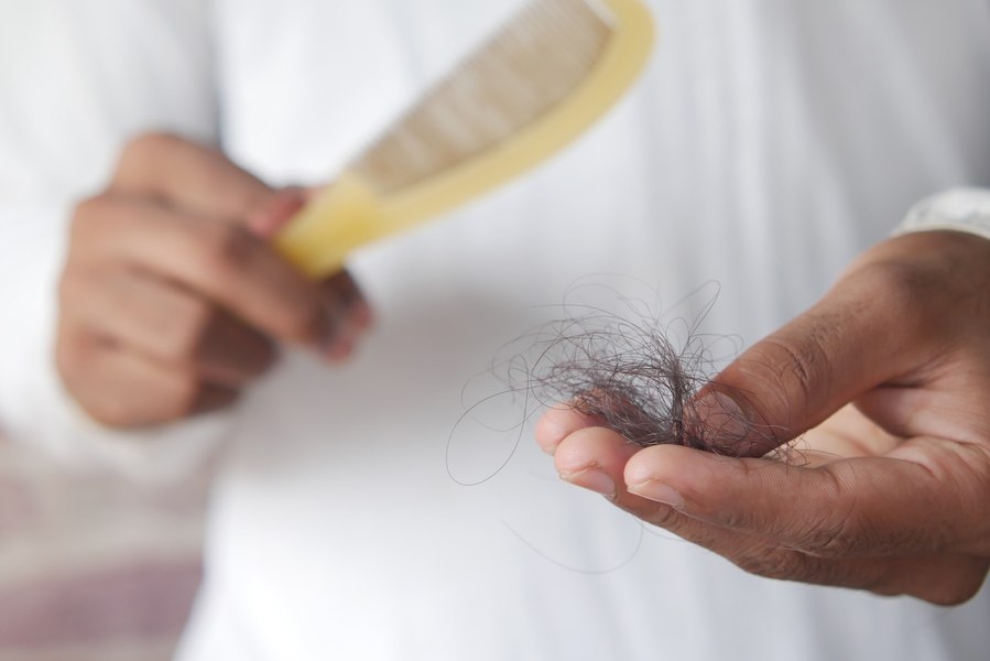 Cum poți preveni alopecia și stimula creșterea părului