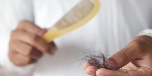 alopecie fire de par pexels jpg