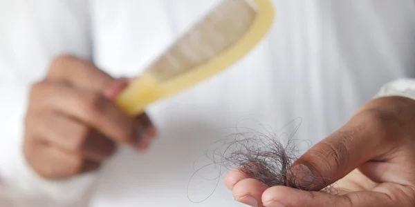 alopecie fire de par pexels jpg