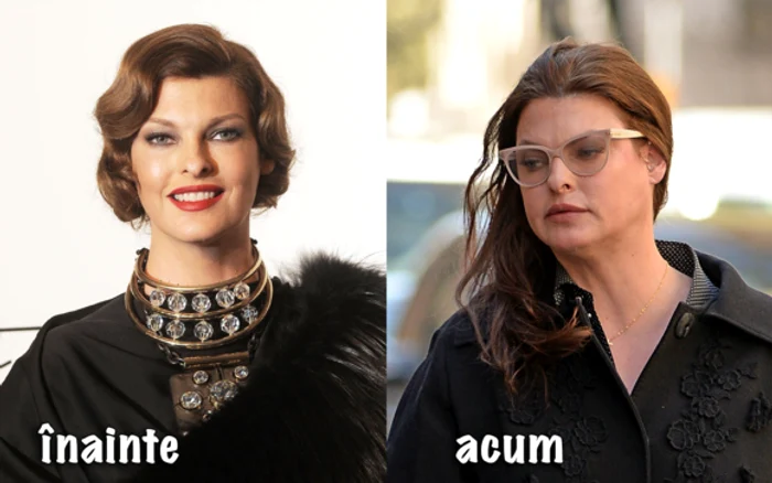 Linda s-a ales cu fața desfigurată, nu mai seamănă cu chipul ei din anii 1990foto: GettyImages