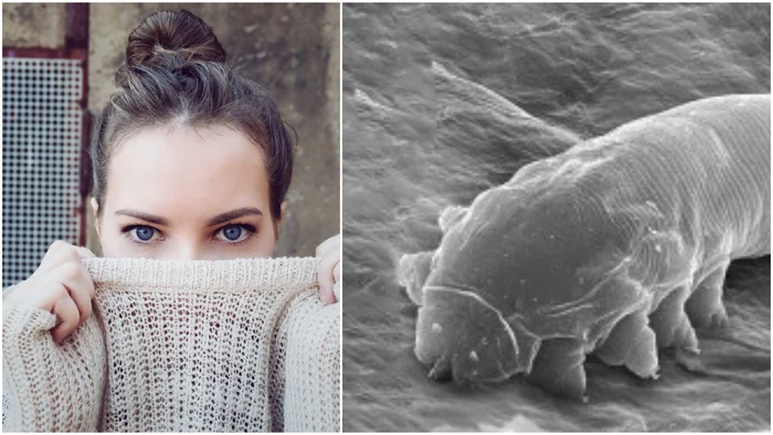 Creaturile cu opt picioare care trăiesc pe fețele oamenilor