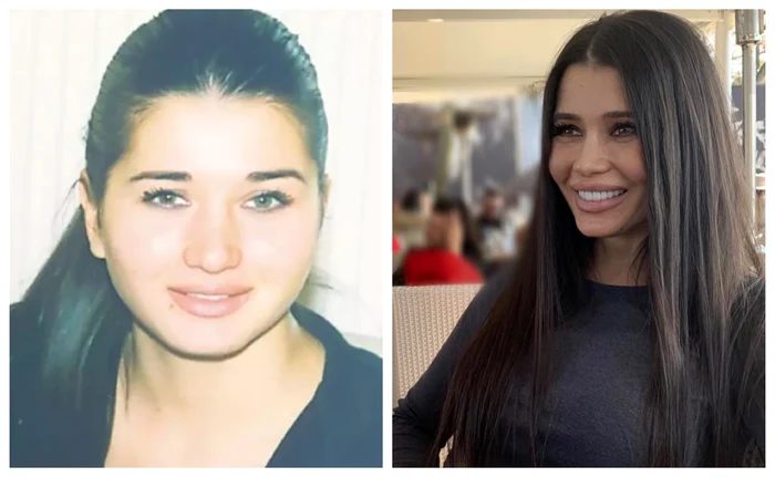 Elena Băsescu și-a făcut mai multe operații estetice / foto: arhiva personala