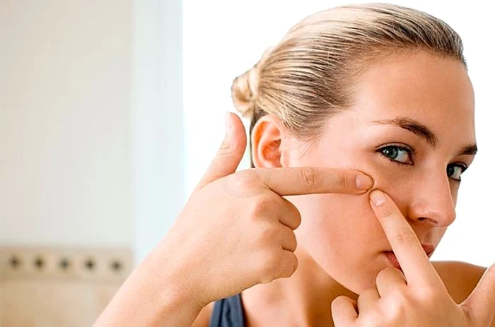 Poţi scăpa rapid de punctele negre de pe faţă cu ajutorul a doar două ingredienteclickpentrufemei.ro