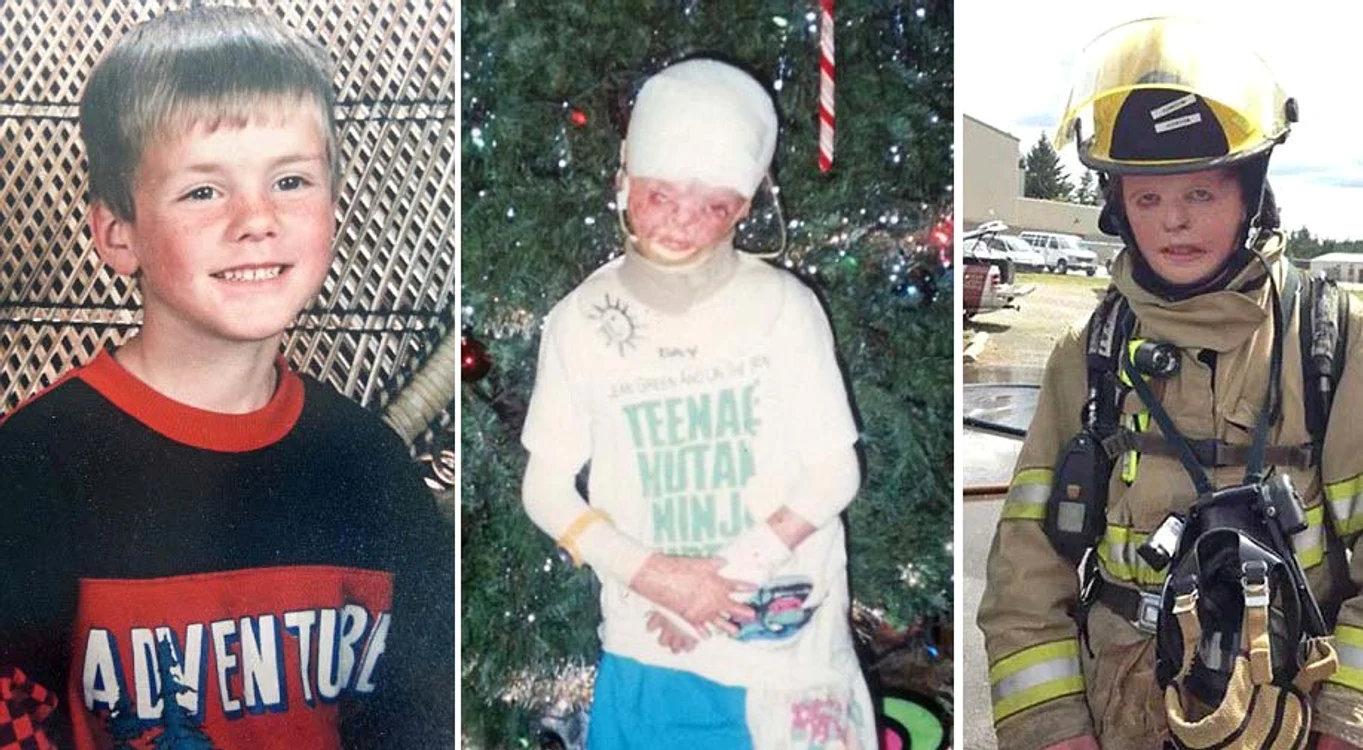 Terry McCarty la şase ani, înainte de a fi ars, după accident şi acum, la 29 de ani, în uniforma de pompier