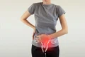 Cancer Ovarian vizual jpg