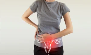 Cancer Ovarian vizual jpg
