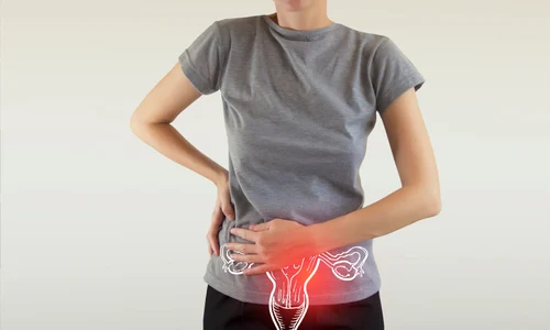 Cancer Ovarian vizual jpg