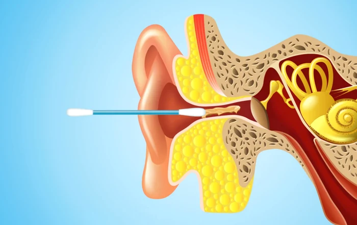 
    Bețișoarele de urechi ne pot afecta în timp auzulFoto Youtube  