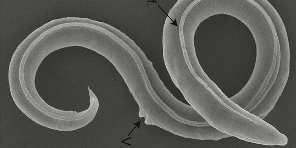 Pic Shatilovich et al , PLOS Genetics, 2023CC FOTO Sky News jpg