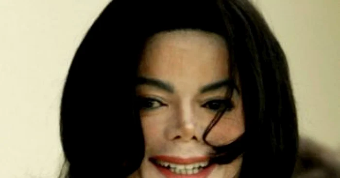 Dermatologul lui Michael Jackson vorbeşte: "Se făceau glume pe seama nasului său!"