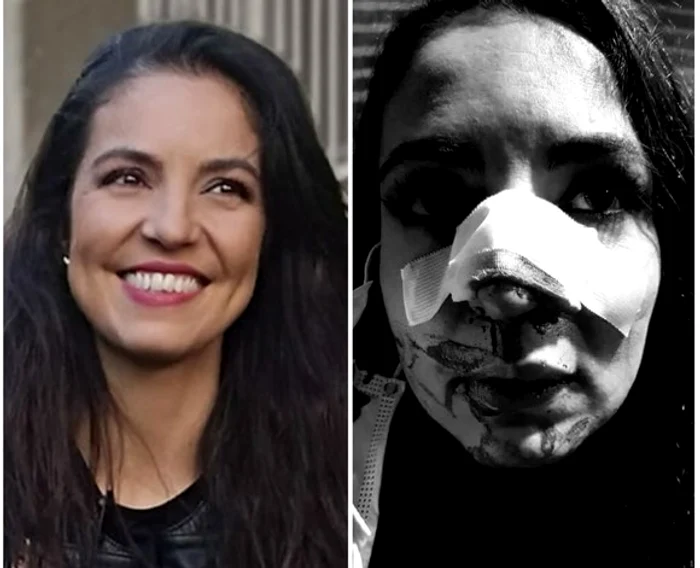 Cristina Joia a trecut prin momente de coșmar în urmă cu o lună Sursă foto: Colaj Click!