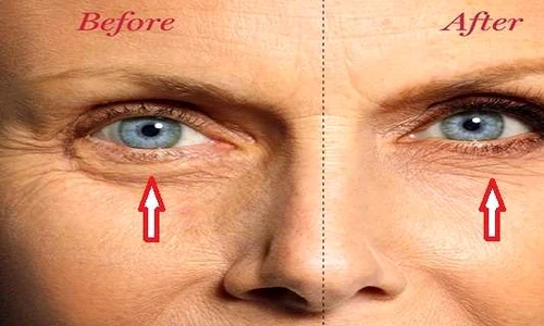 1 serum homemade pentru cercurile negre si pungile de sub ochi remediu simplu si rapid nvef jpg jpeg