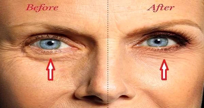 1 serum homemade pentru cercurile negre si pungile de sub ochi remediu simplu si rapid nvef jpg jpeg