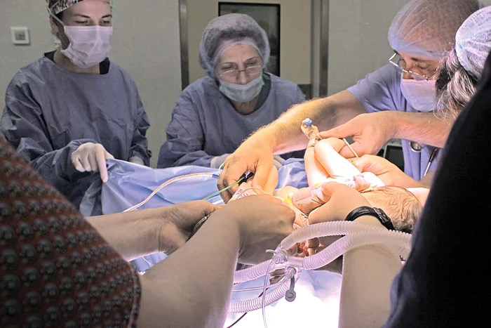 20 de medici chirurgi şi asistenţi au participat la operaţie