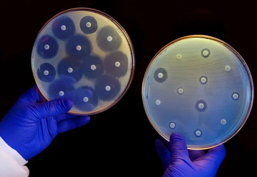 Pericolul superbacteriilor rezistente la medicamente. Pandemia de Covid ar putea părea „minoră”, avertizează experții