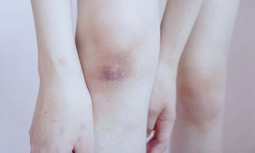 1 62690 original jpg jpeg