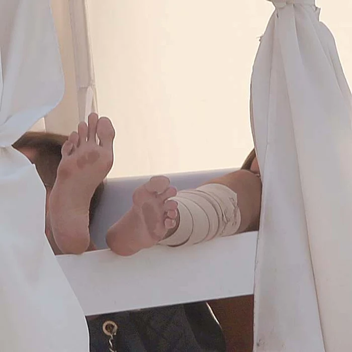 Bianca şi-a scos firele în urma operaţiei şi îşi protejează rana de la picior cu bandaje