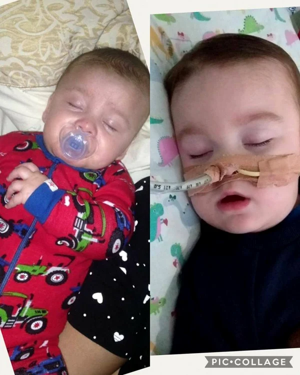 Alfie Evans foto Facebook