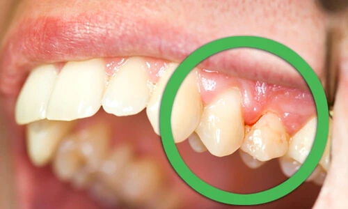 1 71599 original jpg jpeg