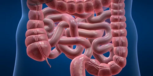 Cancerul colo-rectal este al 3-lea ca frecventa in Romania
