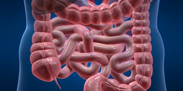 Cancerul colo-rectal este al 3-lea ca frecventa in Romania