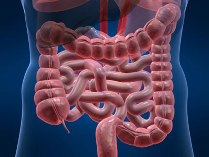 Cancerul rectal poate fi tratat FOTO: Arhivă